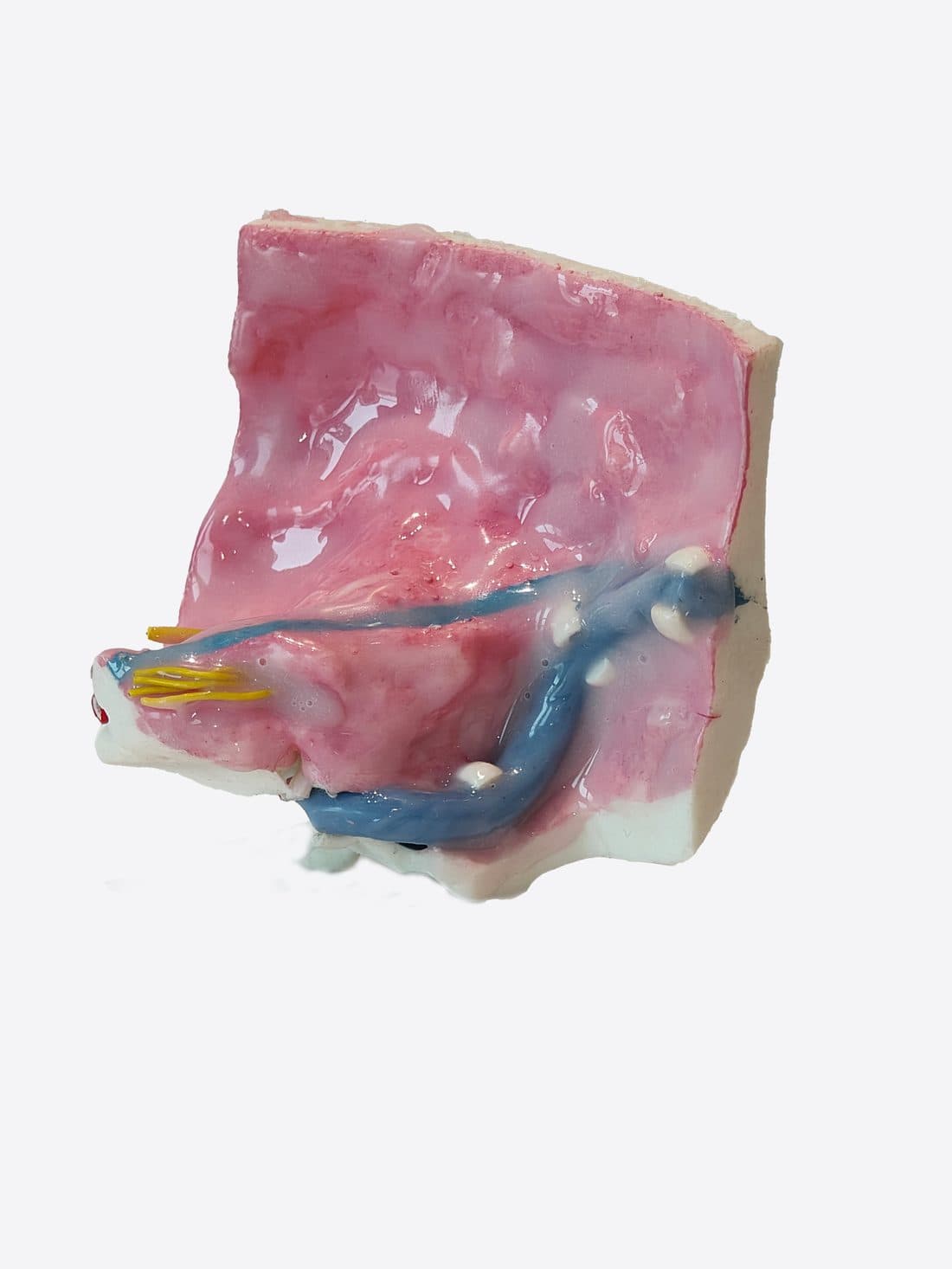 3D temporal bone model