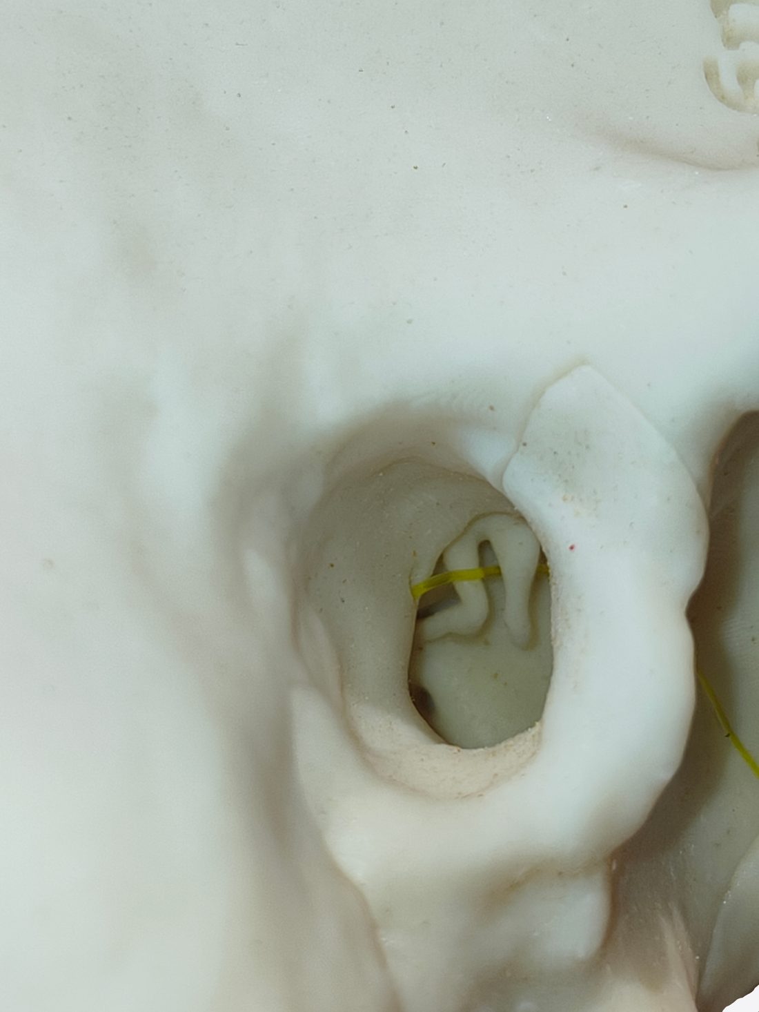 Silicone ear model view 1