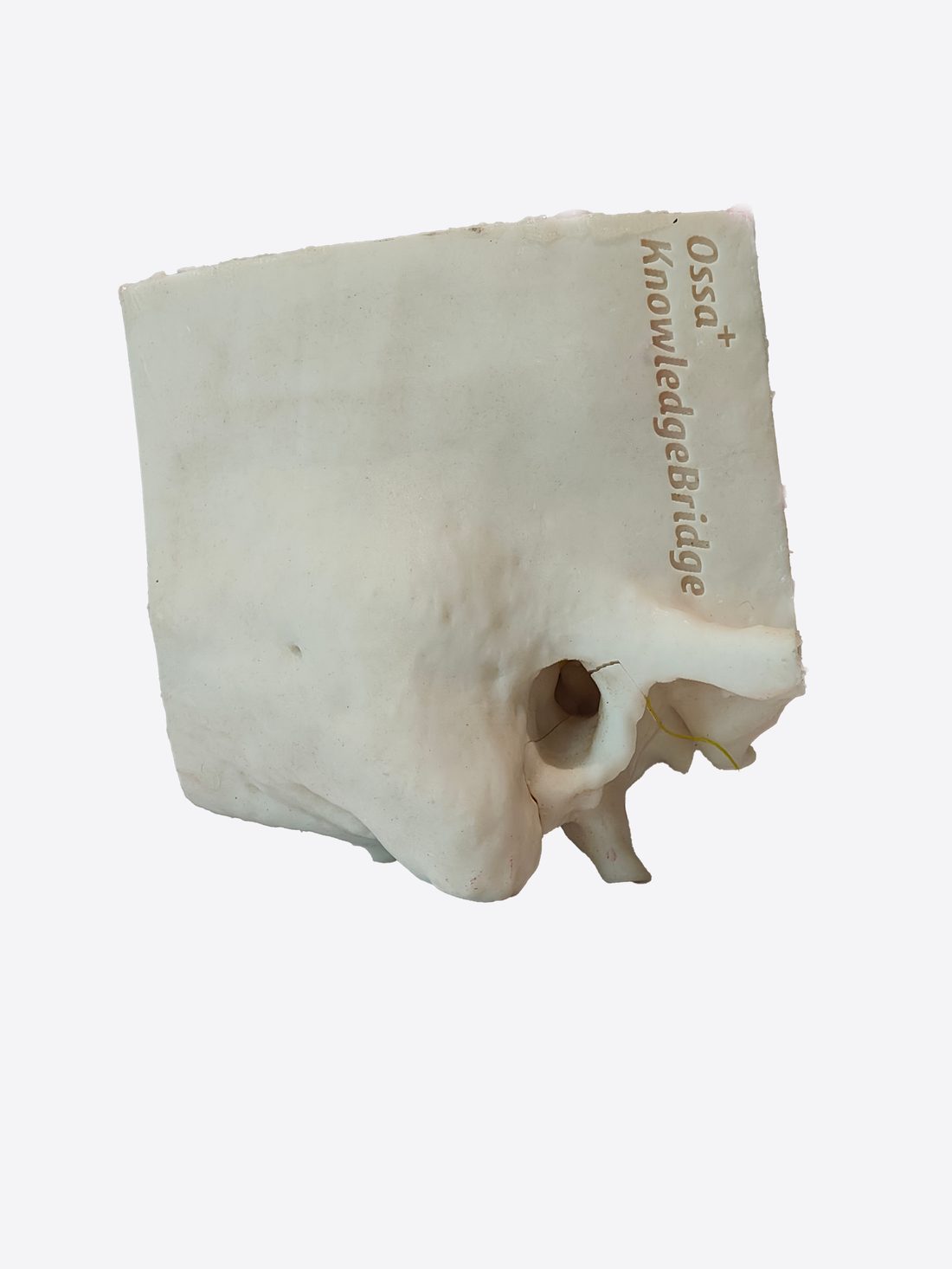 3D Temporal Bone view 2