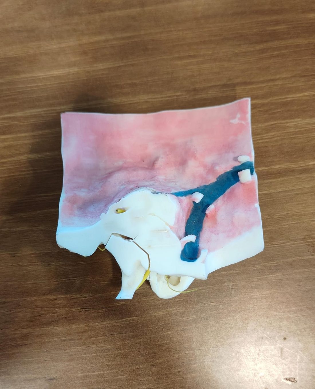 3D Temporal Bone view 3